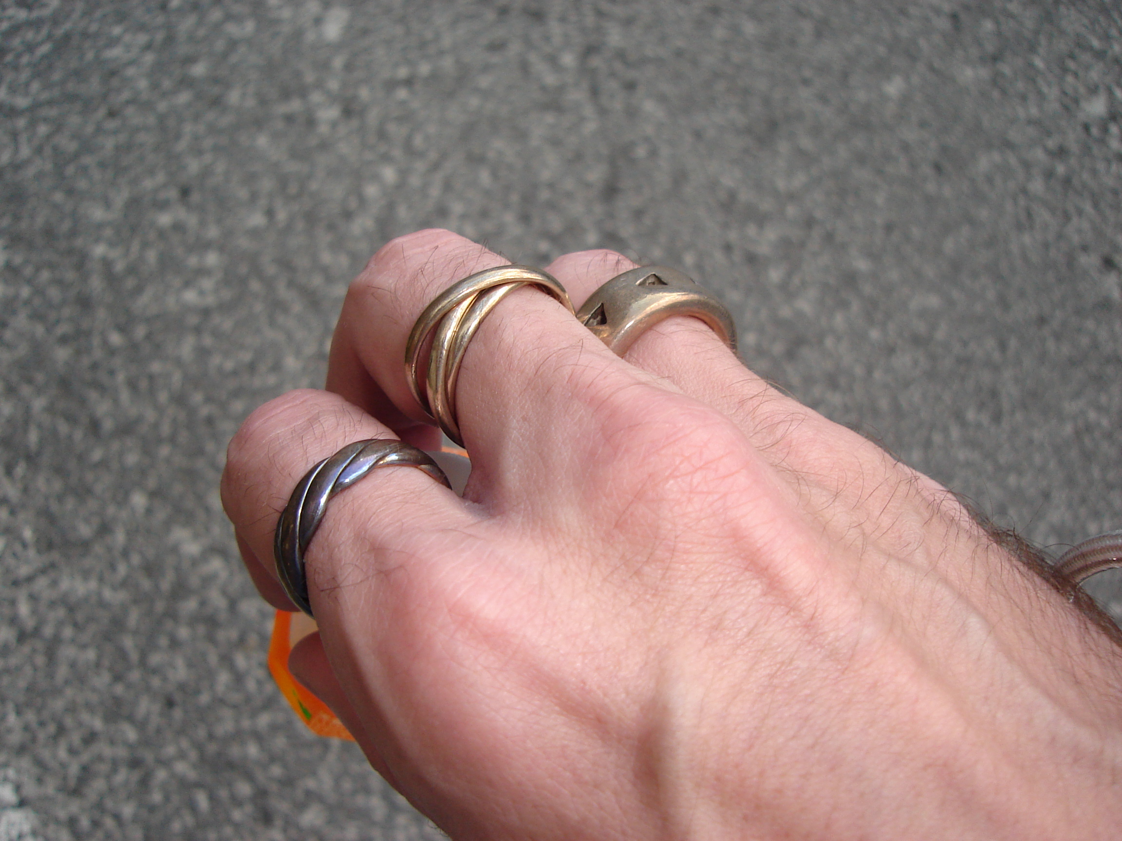 a right hand with rings that look discoloured